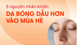 5 nguyên nhân khiến da bóng dầu hơn vào mùa hè