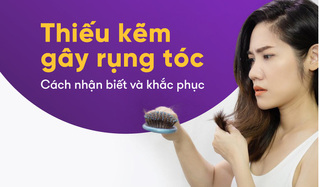 Thiếu kẽm gây rụng tóc – Cách nhận biết và khắc phục