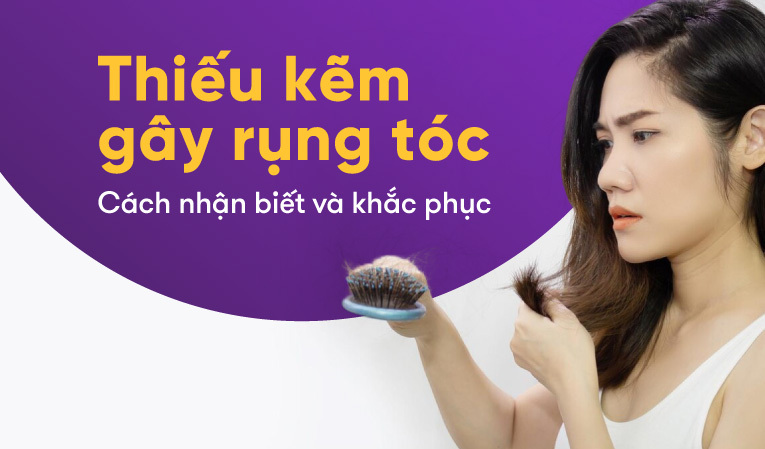 Thiếu kẽm gây rụng tóc – Cách nhận biết và khắc phục