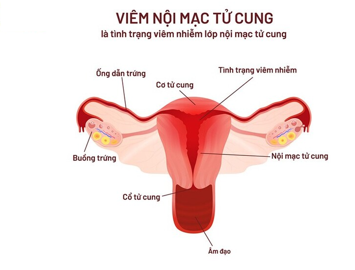 Cách khử mùi hôi âm đạo sau sinh giúp mẹ bỉm lấy lại tự tin