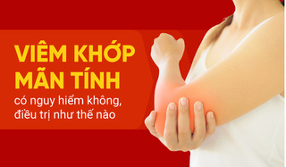 Viêm khớp mãn tính có nguy hiểm không, điều trị như thế nào?