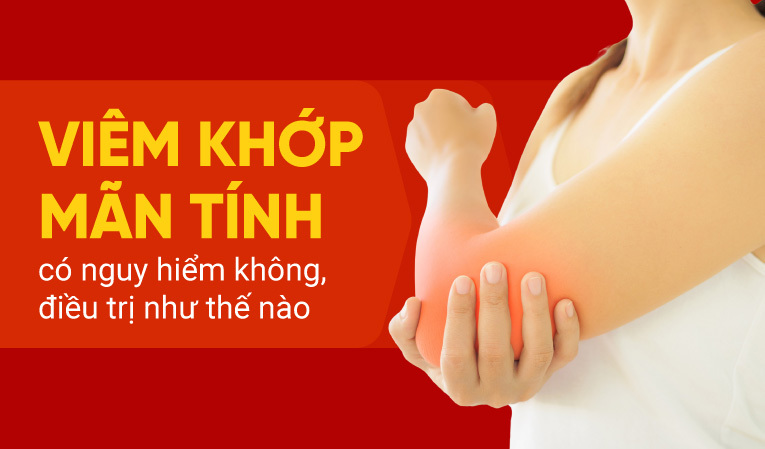 Viêm khớp mãn tính có nguy hiểm không, điều trị như thế nào?