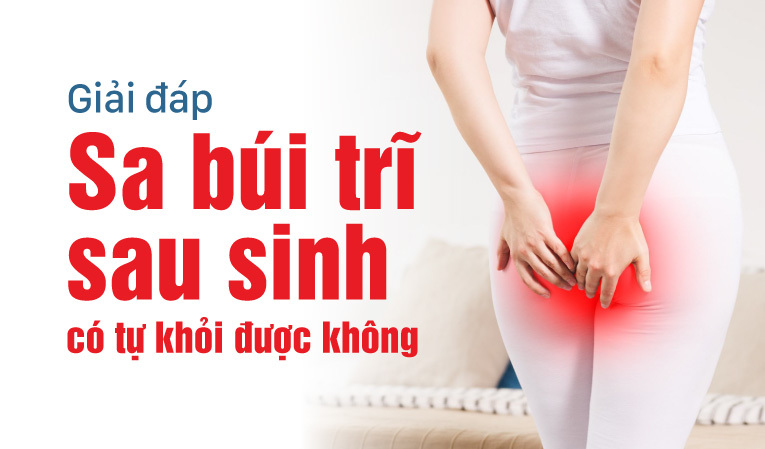Giải đáp: Sa búi trĩ sau sinh có tự khỏi được không?
