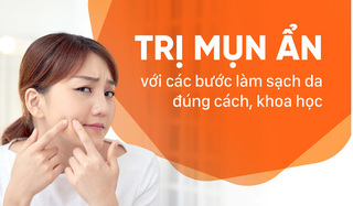 Trị mụn ẩn với các bước làm sạch da đúng cách, khoa học