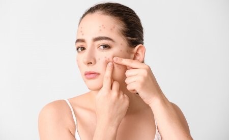 Trị mụn ẩn với các bước làm sạch da đúng cách, khoa học