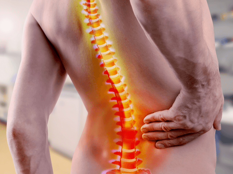 Đau cột sống kéo dài: Những biến chứng nguy hiểm khi không điều trị