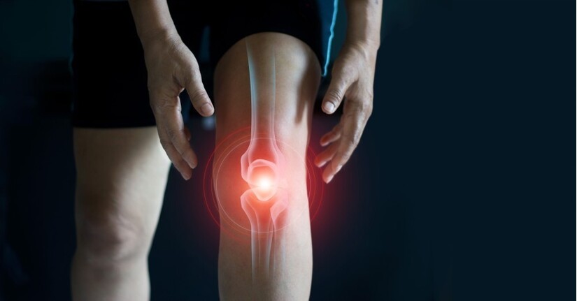 Chữa viêm khớp gối: Giải pháp từ Tây y và Đông y