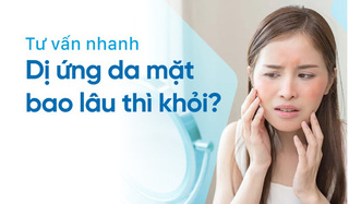 Tư vấn nhanh: Dị ứng da mặt bao lâu thì khỏi?