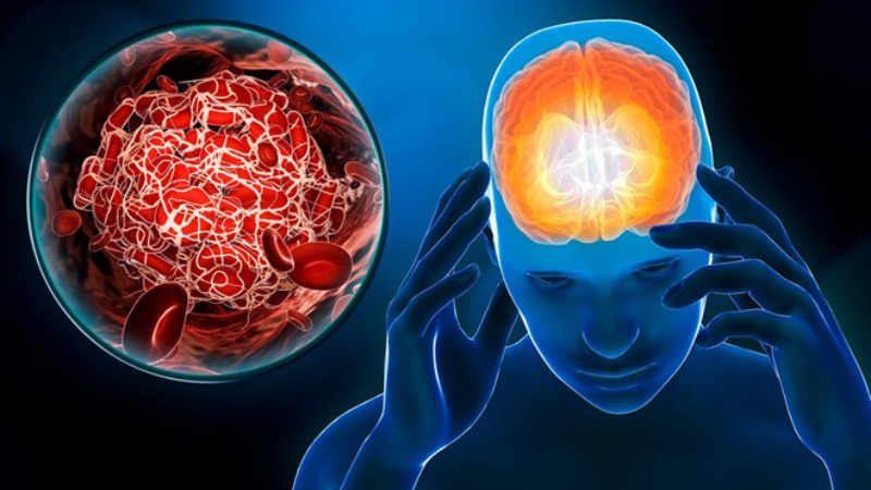 Vì sao bạn khó ngủ? Nên áp dụng ngay nguyên tắc giúp dễ ngủ hơn!
