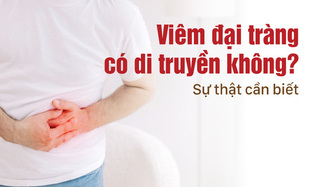 Viêm đại tràng có di truyền không? Sự thật cần biết