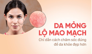 Da mỏng lộ mao mạch: Chỉ dẫn cách chăm sóc đúng để da khỏe đẹp hơn