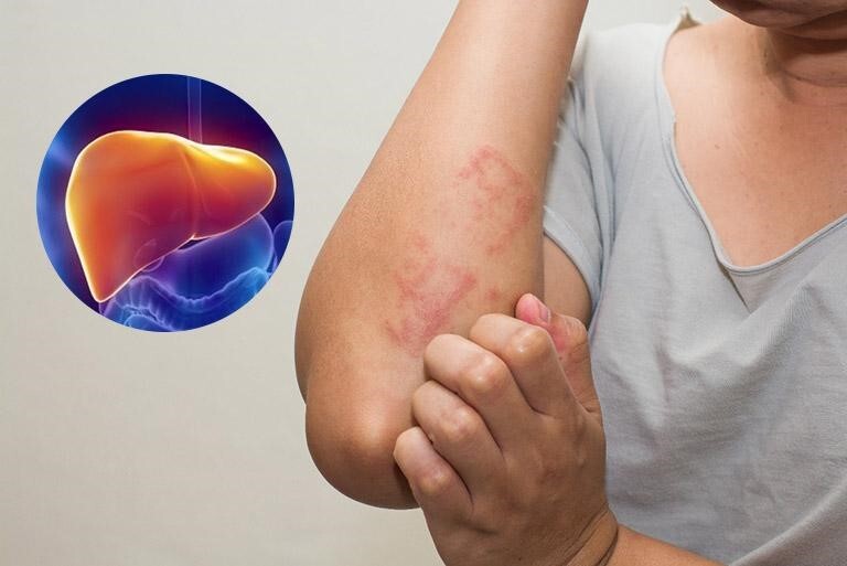 Thắc mắc “uống gì mát gan, giải độc gan?” – Đây là câu trả lời