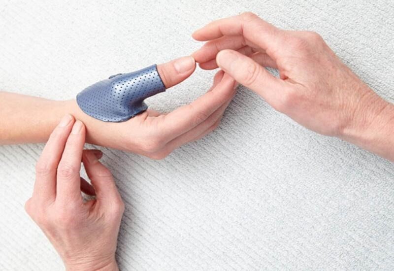 Giật mình với biến chứng nguy hiểm của viêm khớp ngón tay cái