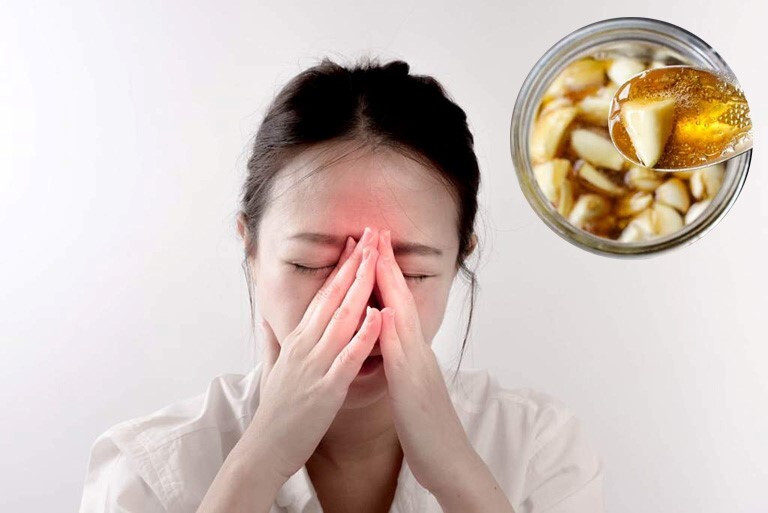 Lưu ngay những cách trị ngạt mũi cho người bị viêm xoang mãn tính