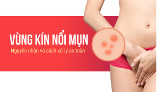 Vùng kín nổi mụn: Nguyên nhân và cách xử lý an toàn