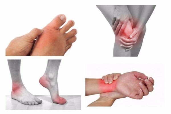 Đau nhức tay chân: Nguyên nhân, triệu chứng và biện pháp cải thiện