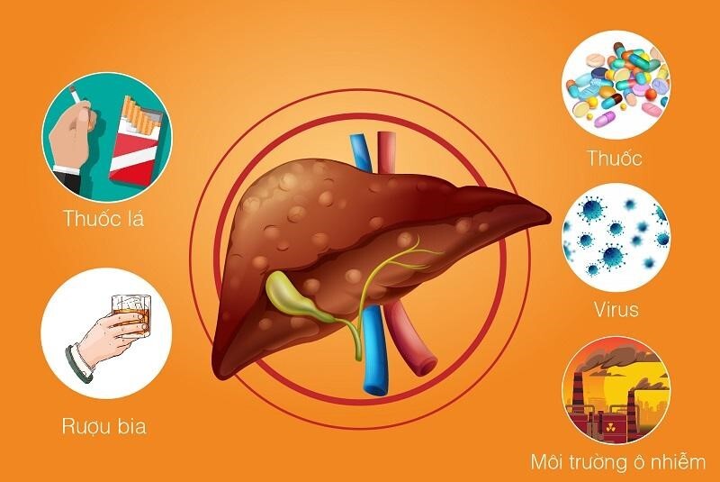 Bí quyết mát gan giải độc gan ngay tại nhà, ai cũng làm được