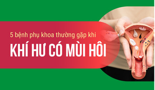 5 bệnh phụ khoa thường gặp khi khí hư có mùi hôi