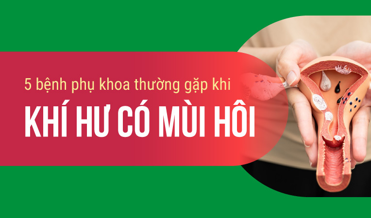 5 bệnh phụ khoa thường gặp khi khí hư có mùi hôi