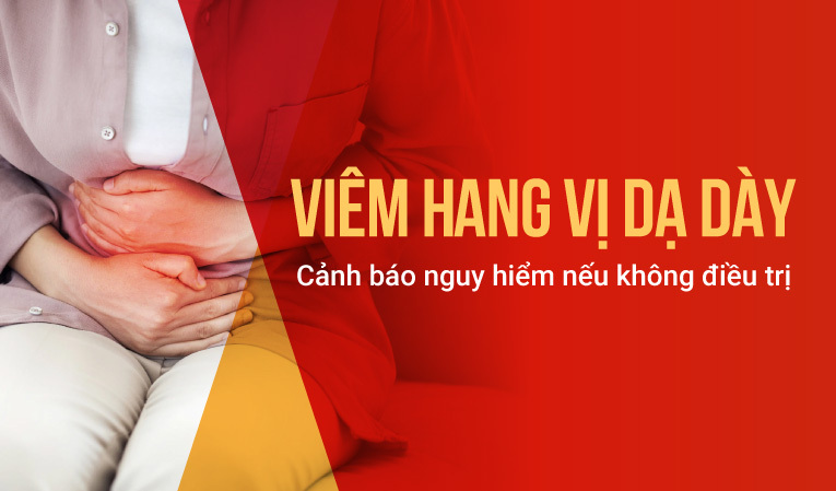 Viêm hang vị dạ dày: Cảnh báo nguy hiểm nếu không điều trị