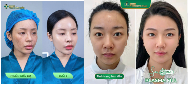 Vì sao Phòng khám Da liễu 42 Liễu Giai là "Địa chỉ vàng" điều trị nám chuẩn Y khoa tại Hà Nội?