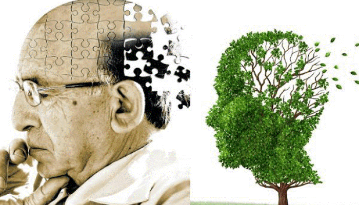 Hay quên, suy giảm trí nhớ Biểu hiện sớm của thiểu năng tuần hoàn não