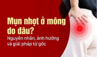 Mụn nhọt ở mông do đâu? Nguyên nhân, ảnh hưởng và giải pháp từ gốc