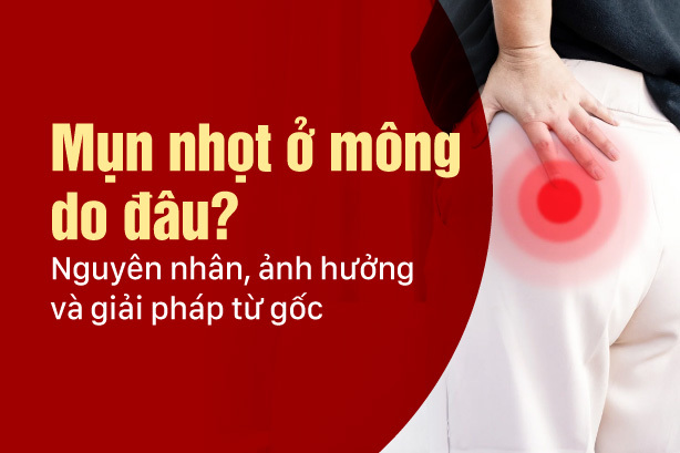 Mụn nhọt ở mông do đâu? Nguyên nhân, ảnh hưởng và giải pháp từ gốc