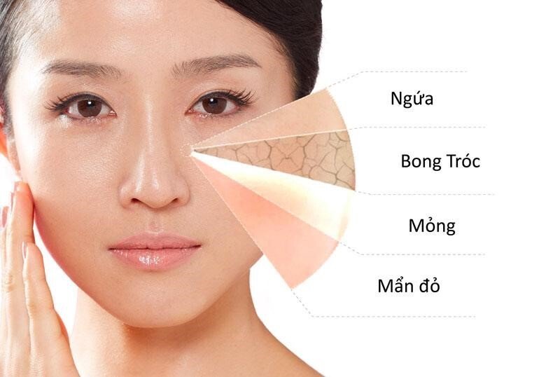 Sữa rửa mặt dành cho da nhạy cảm Bí quyết làm sạch an toàn và dịu nhẹ