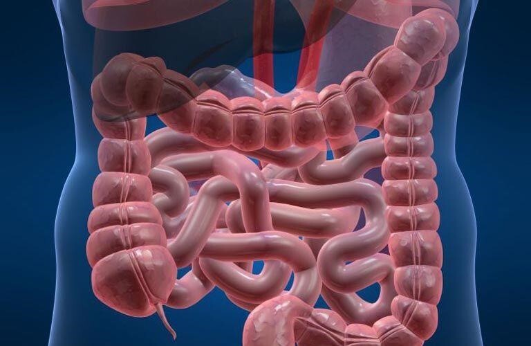Viêm đại tràng kiêng gì để kiểm soát bệnh tốt hơn?