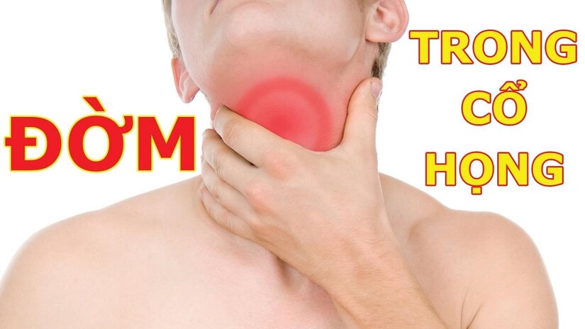 Bị vướng đờm ở cổ họng: Nguyên nhân, triệu chứng và cách xử lý