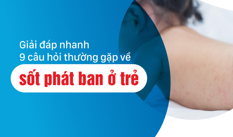 Giải đáp nhanh 9 câu hỏi thường gặp về sốt phát ban ở trẻ