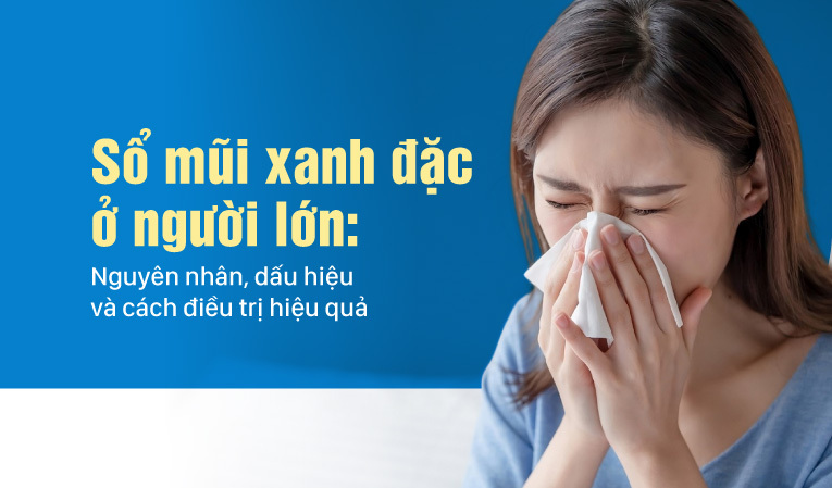 Sổ mũi xanh đặc ở người lớn: Nguyên nhân, dấu hiệu và cách điều trị