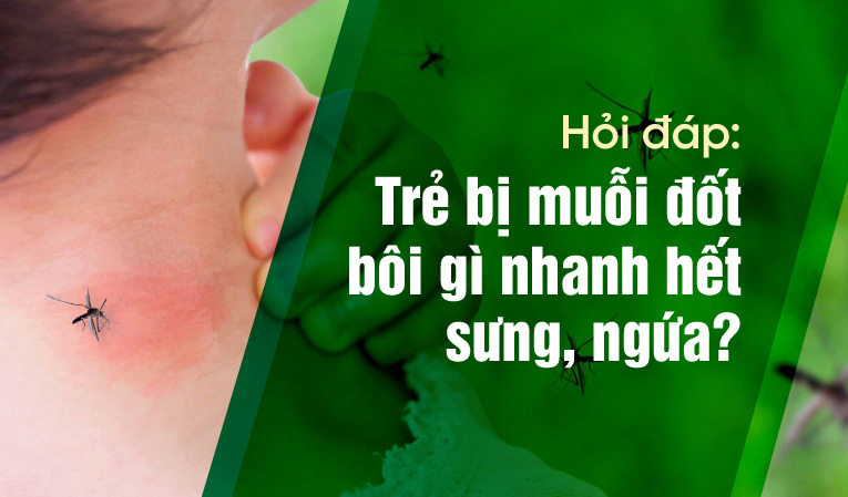 Hỏi đáp: Trẻ bị muỗi đốt bôi gì nhanh hết sưng, ngứa?