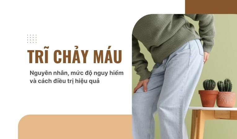 Trĩ chảy máu: Nguyên nhân, mức độ nguy hiểm và cách điều trị hiệu quả