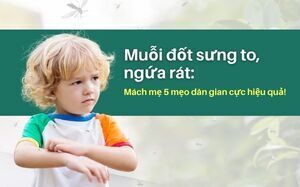 Muỗi đốt sưng to, ngứa rát: Mách mẹ 5 mẹo dân gian cực hiệu quả!