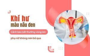 Khí hư màu nâu đen – Cảnh báo bất thường vùng kín