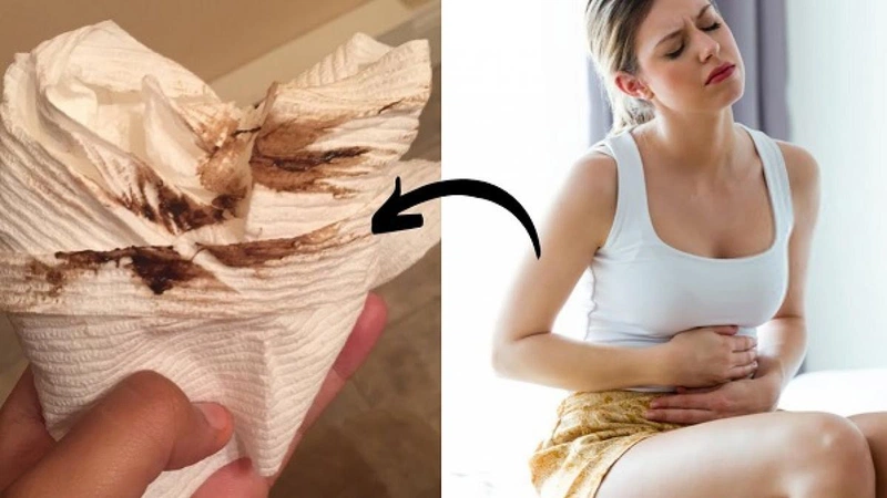 Khí hư màu nâu đen – Cảnh báo bất thường vùng kín