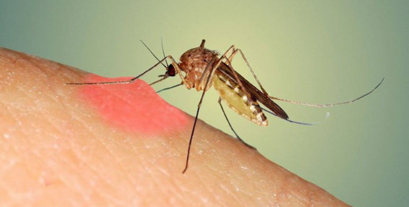 Trị vết muỗi đốt bằng nguyên liệu tự nhiên: So sánh ưu nhược điểm