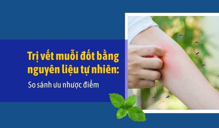 Trị vết muỗi đốt bằng nguyên liệu tự nhiên: So sánh ưu nhược điểm