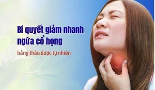 Bí quyết giảm nhanh ngứa cổ họng bằng thảo dược tự nhiên