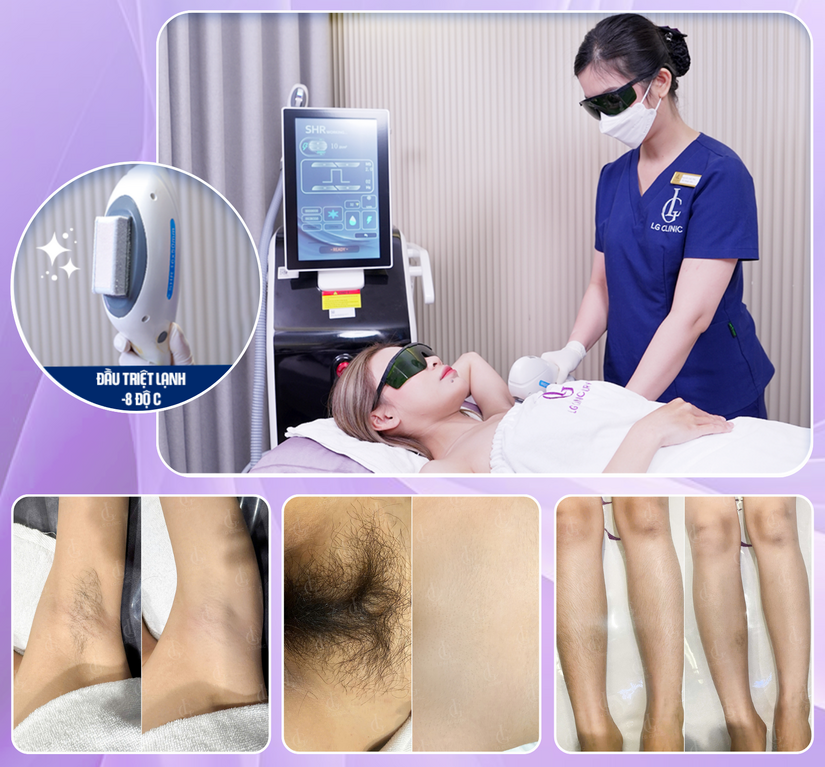 Triệt lông vĩnh viễn giá bao nhiêu? Nên triệt ở đâu uy tín tại TP.HCM?