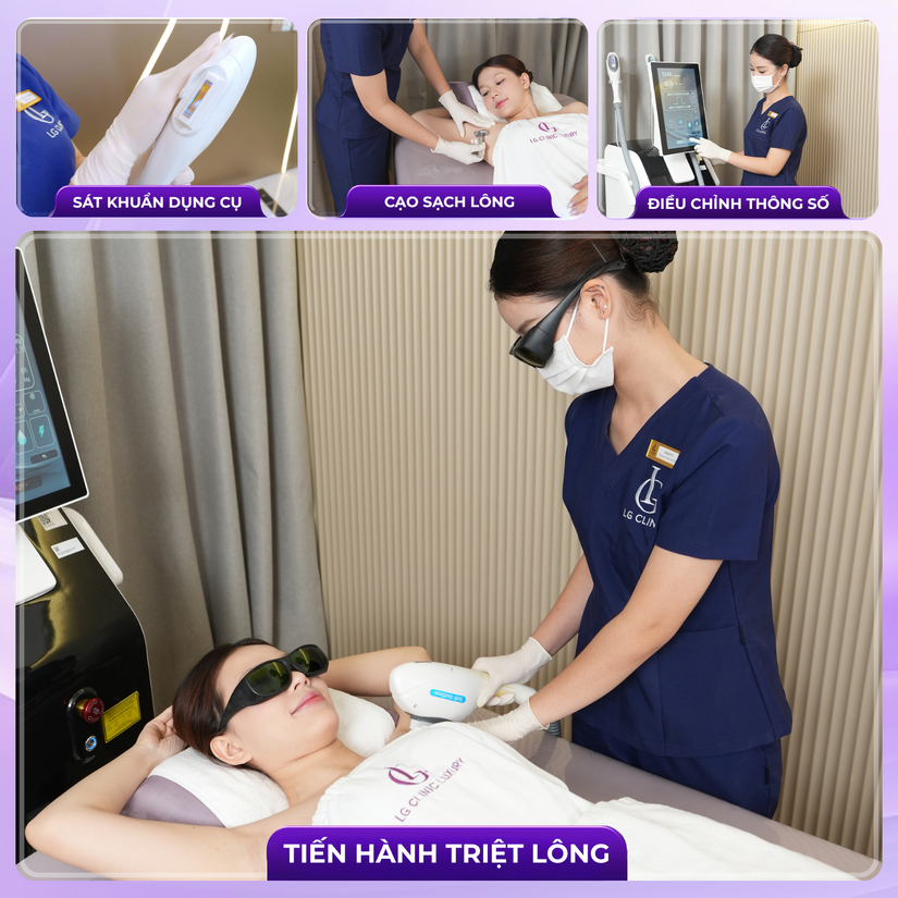 Triệt lông vĩnh viễn giá bao nhiêu? Nên triệt ở đâu uy tín tại TP.HCM?