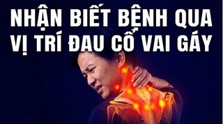 Nhận biết bệnh qua vị trí đau cổ vai gáy