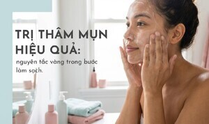 Trị thâm mụn hiệu quả: nguyên tắc vàng trong bước làm sạch