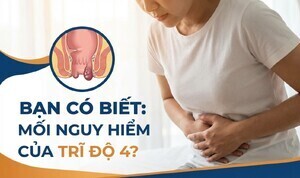 Bạn có biết: Mối nguy hiểm của trĩ độ 4?