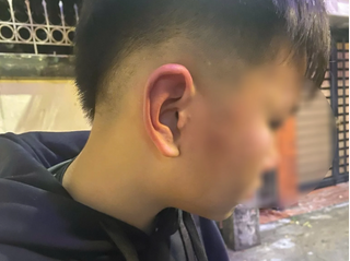 Công an xác minh nghi vấn bé trai ở Hà Nội bị bố của bạn hành hung khi đến nhà bạn học chơi