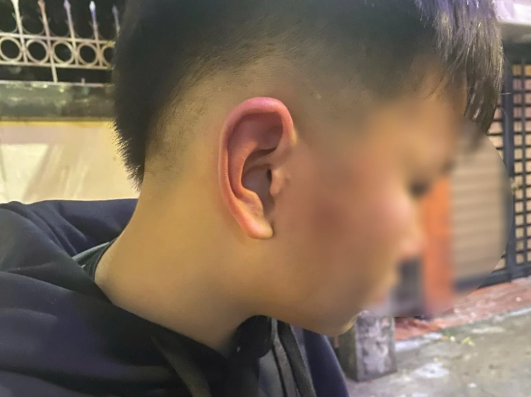 Công an xác minh nghi vấn bé trai ở Hà Nội bị bố của bạn hành hung khi đến nhà bạn học chơi