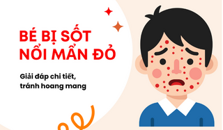 Bé bị sốt nổi mẩn đỏ: Giải đáp chi tiết, tránh hoang mang