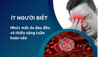 Ít người biết nhức mắt do đau đầu và thiểu năng tuần hoàn não